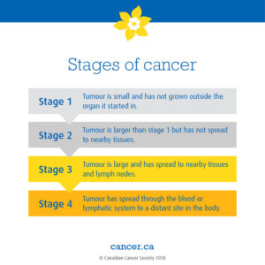 Stage of cancer image definition...