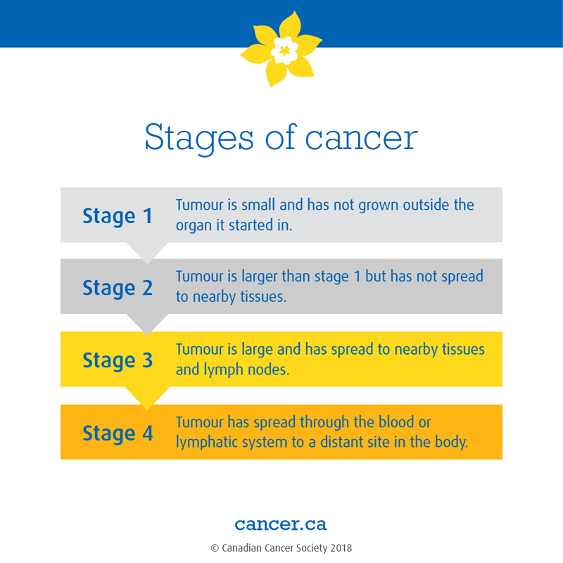 Stage of cancer image definition...
