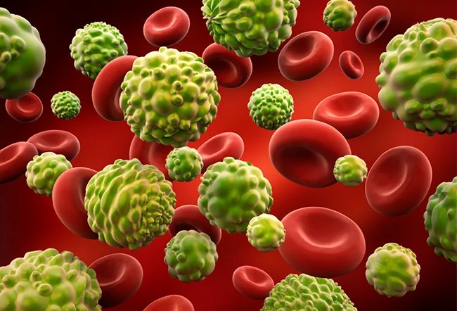 ITP ( Blood Platelets..